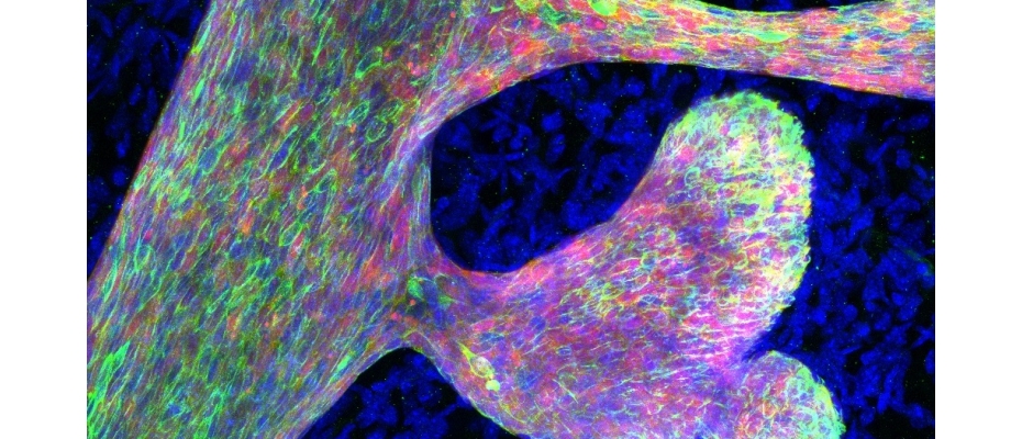 Immunofluorescence staining for mammary epithelium (red), highlighting the luminal lineage (green), showing aberrant mammary branching upon perturbed chromatin accessibility (IRB Barcelona)
