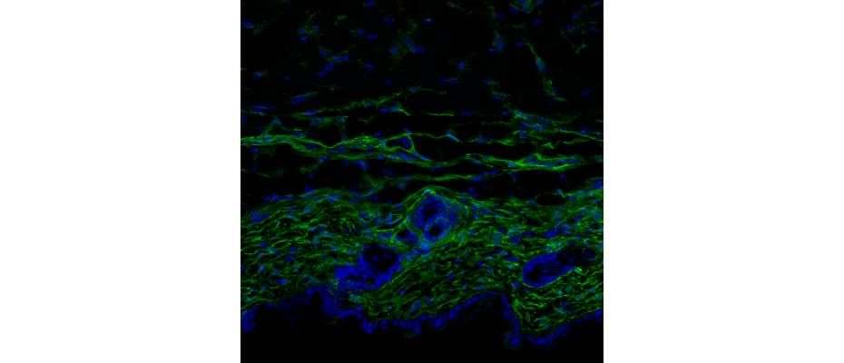 Skin of a young mouse. The image shows a cross section of the skin with the fibroblasts indicated in green. The thickness of the dermis and the density of fibroblasts is much greater in young skin than in aged skin– cell nuclei, in blue (M Salzer, IRB)